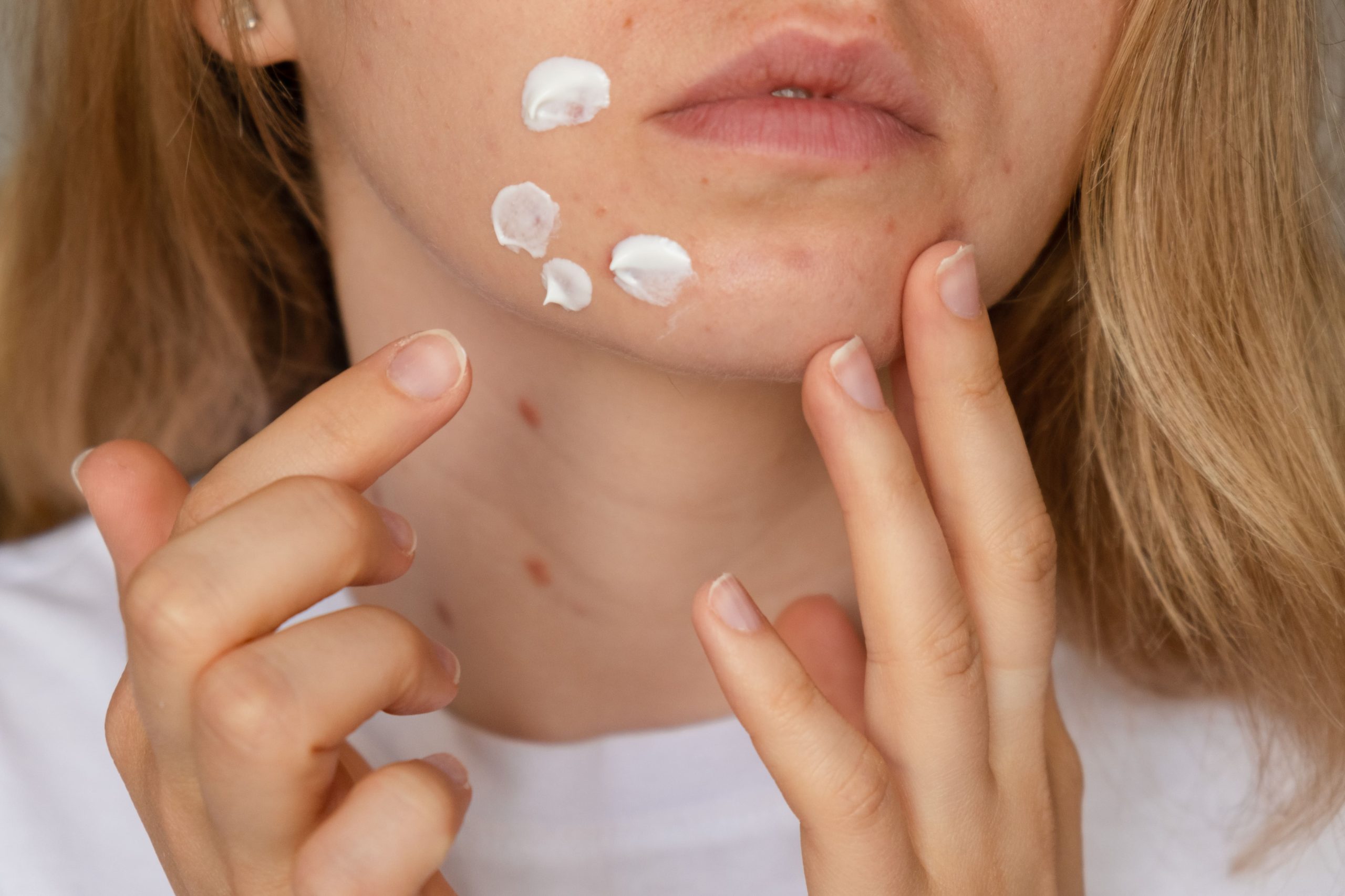 A woman applying cream serum to her face with a gentle touch.